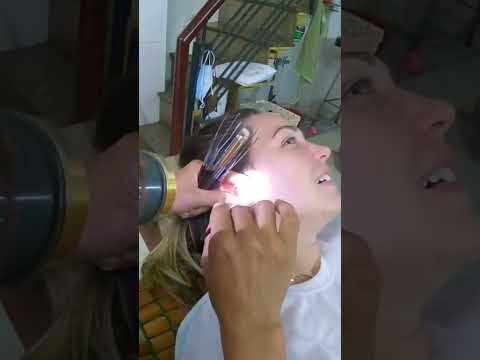 Limpieza de oídos extrema en #Vietnam 👂🏻 ¿lo harías? | #shorts #earcleaners #earmassage