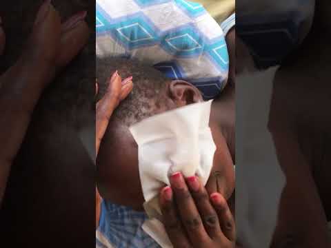 Face Nitpicking on my baby Asmr #asmrsounds #headscratches #asmreating #asmr #asmrvideo