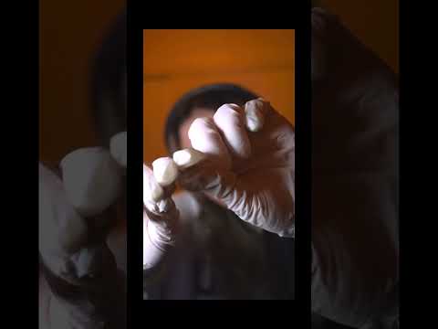 SACANDO PUNTOS NEGROS #asmr