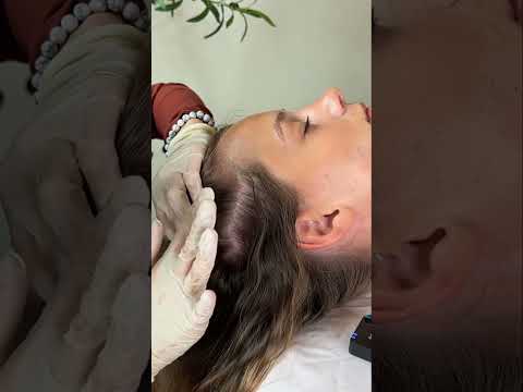 Asmr scalp tingles #asmr #asmrsounds #asmrvideo #relax #relaxing #satisfying #hair #sleep #tingles
