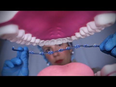 ASMR | DENTISTA COLOCA APARELHO FIXO EM VOCÊ 