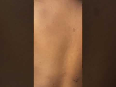 ASMR BACK MASSAGE AND SCRATCHING FOR SLEEP #asmr #skincare #earpicking ##backscratching
