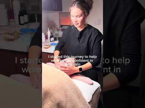 Kelly’s Acne Journey