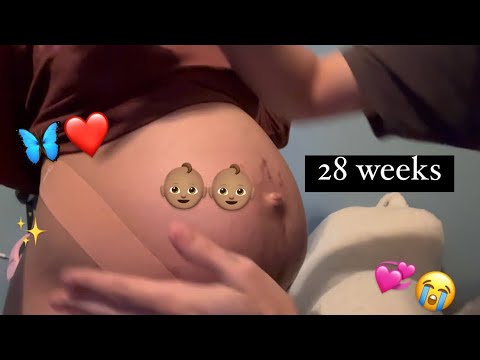 Vlog # 208 - Twin Specialist at 28 weeks