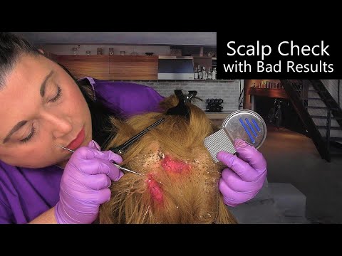 ASMR Scalp Check with Bad Results (Lice Check, Scalp Treatment, Hair Wash) Medical Roleplay