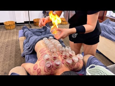 ASMR 🇻🇳 Strong Cupping Therapy at Vanessa Spa in Vietnam | Deep Relaxation