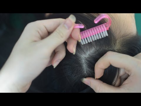ASMR Tingly Scalp Scratch, Scalp Massage Fast And Aggressive On Real Person For Relieve Stress