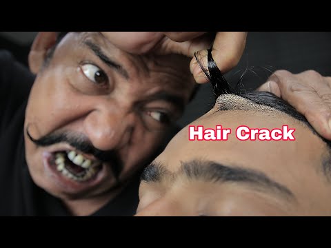Amazing Hair Crack And Nasal Bridge Crack By Asim Barber | Neck Crack & Ear Crack Head Massage ASMR