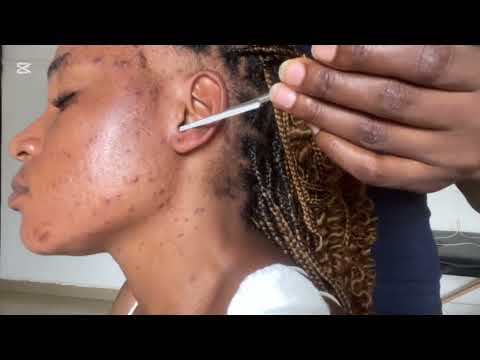ASMR EAR CLEANING AND NITPICKING, SPIT PAINTING, EAR LICKING, EAR EATING, EAR BITTING, SCALP SCRATCH