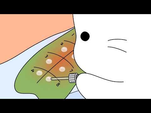 Skin Examination & Allergy Test | ASMR animation