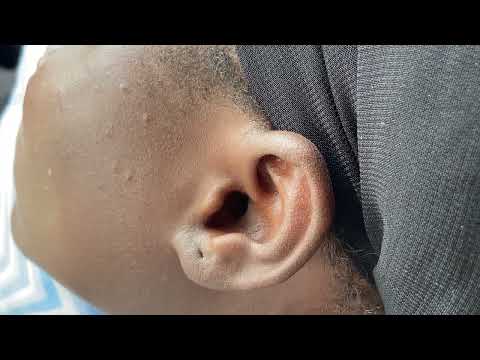 ASMR GENTLE EAR PICKING WITH TOOLS, RELAXING EAR CLEANING WITH CHEWING GUM