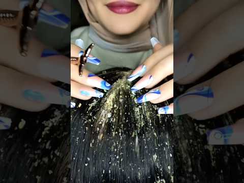 Dandruff Removal💆🏻‍♀️😱Scratching Massaging#asmr #asmrmassage #scratching #shorts #canada #massage