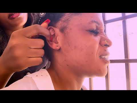 FAST AGGRESSIVE ASMR Ear Cleaning & Head Scratch Massage | INSANE Brain Tingles