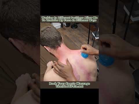 Cupping the Upper Trapezius