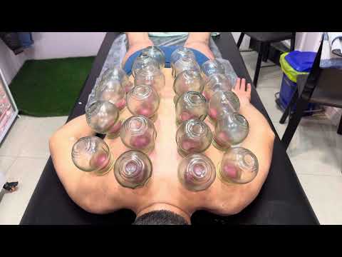 #video #massage #asmr #explore #viralvideo #youtube #relax #cupping #cuppingtherapy