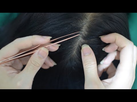 ASMR Scalp Check, Scalp Picking, Hair Parting & Hair Plucking For Relaxation ( No Talking )