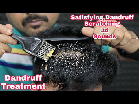 Satisfying Dandruff Scratching ASMR Dandruff Treatment by biswajit barber