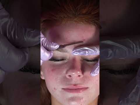 Instant Glass Skin! Dermaplaning That SHOCKS Everyone #shorts