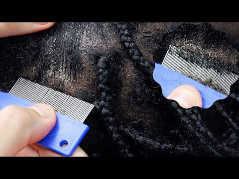 Deep Scratching & Picking Btn Braids with a lice comb ~ BEST TRIGGERS FOR SLEEP 😴 | soft whisper