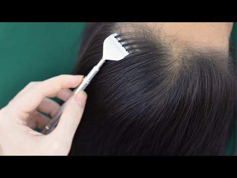 ASMR Scalp Scratching Aggressive, Scalp Massage With Gloves Relaxing For Relieve Stress