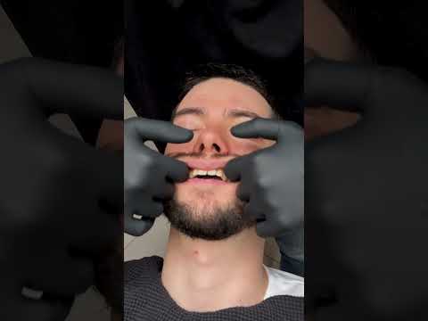 Visit the channel for the continuation😌🪷 #barber #asmr #relax #massage