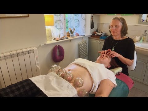 ASMR Kinesiology Abdominal Massage Cupping to treat Endometriosis | Abdominal Massage