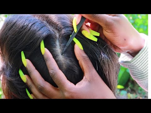 Nitpicking Scalp Whiteheads In The Forest | Peaceful ASMR FOR SLEEP | Birds & Cricket Sounds