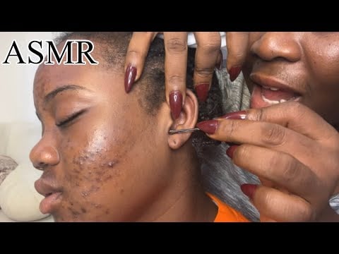 ASMR✨Face Pimple pop, Bobby pin, Tooth-pick, Dental floss and Deep Ear Cleaning