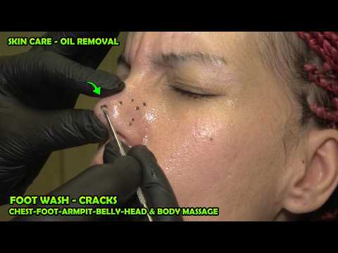 SENSITIVE LADY'S SKIN CARE & OIL REMOVAL + CRACKS + WASH + ASMR chest,ear,foot,armpit & body massage