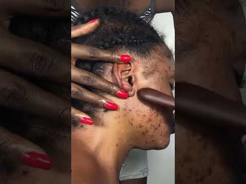 ASMR Ear Massage, Back & Shoulder Massage, Scalp Scratching & Tapping for Deep Sleep