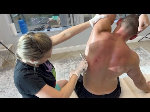 HUGE Knots Popped Out of His Back! Chiro CRUNCHES Strong Man's Back for Tension Relief