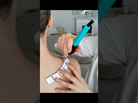 Shoulder skin examination