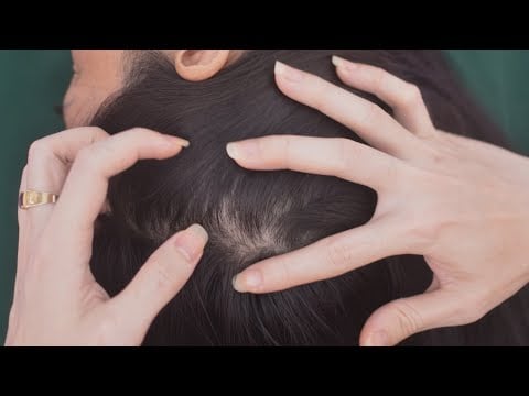 ASMR Soothing Scalp Scratch, Head Scratching Real Person For Relieve Stress, Headache ( No Talking )