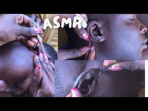 Asmr Ear Picking & Attentive Cleaning For Those Who Want To Sleep. #asmr #earcleaning #nitpicking