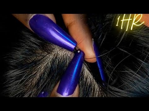 {ASMR} 1 HR Super Attentive NITPICKING SCALP WHITEHEADS | soft spoken | zoomed