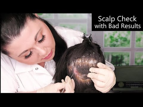 ASMR Scalp Check with Bad Results (Dandruff Removal, Scalp Treatment, Whispering) Medical Roleplay