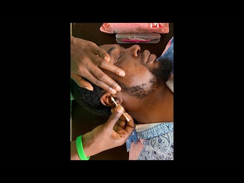 ASMR EAR PICKING/ WITH FINGERS AND TOOL
