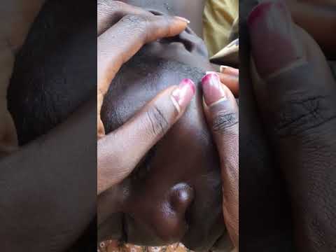 Face Nitpicking and touching #tingling #asmrscratching #nitpicking #tinglyfeeling #asmrsounds