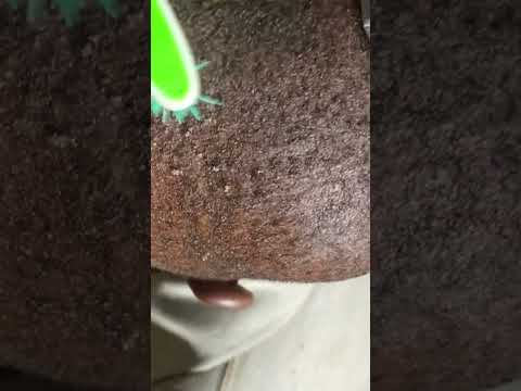 Dandruff Removal & Scratching On Scalp #asmr #dandruff #flakes #asmrvideos #tinglyfeeling