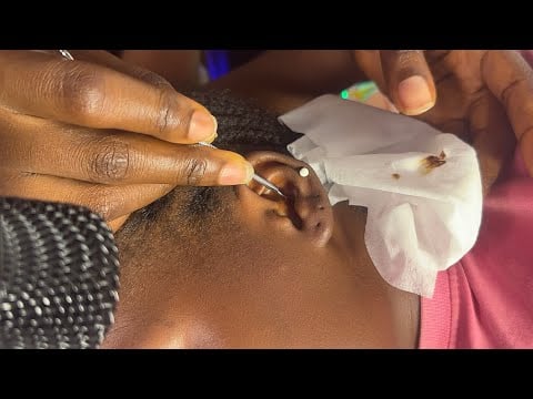 ASMR PROFESSIONAL EAR CLEANING AND NITPICKING MASSAGE FOR THOSE WHO NEED TO UNWIND, SLEEP NOW
