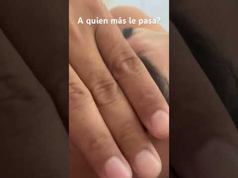 ¿A quien más le pasa? 🫢