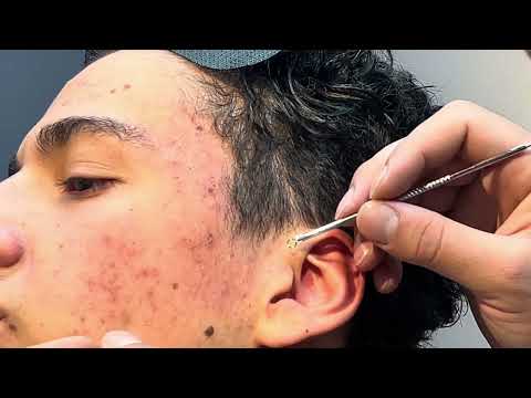 Incredible Skin Care That Leaves Skin Like a Minefield