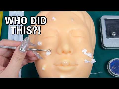 ASMR I Fix Your Botched Plastic Surgery 😳 Extreme Pimple Popping Roleplay