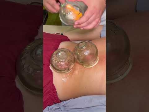 ASMR: Chinese FIRE Cupping and Tuina Massage #shorts