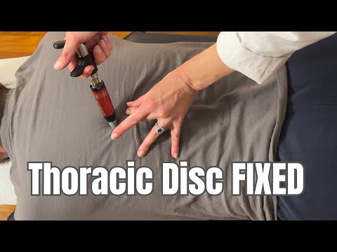Everything I Did for This Thoracic Disc Injury (Step-by-Step ASMR)