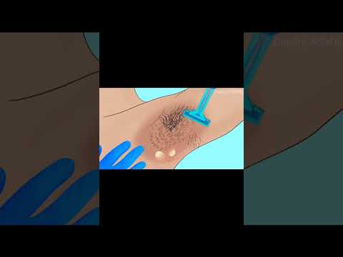 underarm hair removal animation|| ASMR animation|| #asmranimation #animation #2danimation