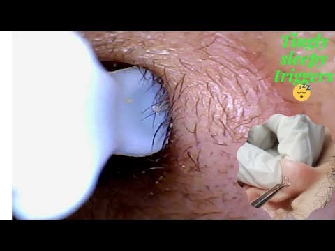 ASMR RARE LOOK DEEP INSIDE The Ear | Cleaning | Soft Sleep Whispers