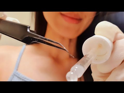 ASMR Ear Cleaning On My Lap 🌖 earwax removal extraction, test exam latex gloves, ear drop blowing