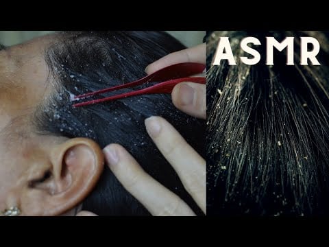 ASMR Scalp Check / Salp Scratching / Scalp Treatment ( Dandruff Removal ) Relaxing For Sleep