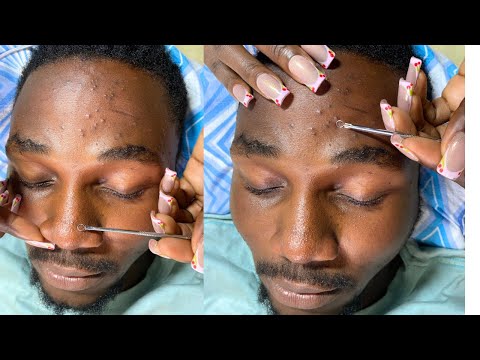 TINGLING FACE NITPICKING FOR THOSE WHO WANT TO SLEEP - RAIN SOUND 🌧️